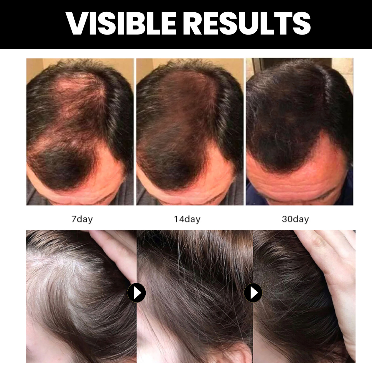 Batana Hair Oil – Anti-Hair Loss & Deep Moisturizing Treatment