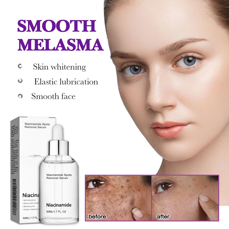10% Niacinamide Spots Removal Serum