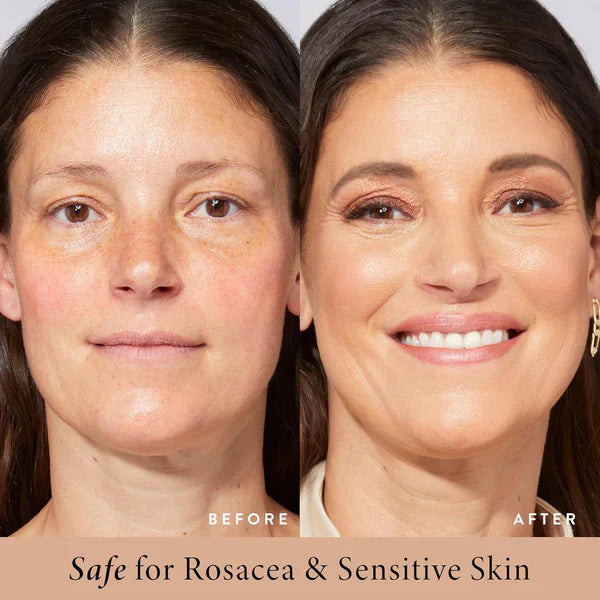 🔥LAST DAY PROMOTION - 50% OFF💜Serum Boosted Skin Tint Balm