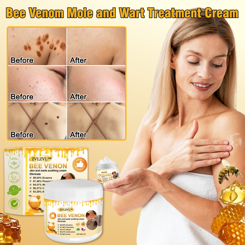 Bee Venom Mole and Wart Treatment Cream🍃[👨‍⚕AAD RECOMMENDS]( Suitable for use byindividuals of all ages)