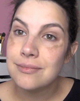 ENVISHA™ Dark Spot And Acne Corrector Cream