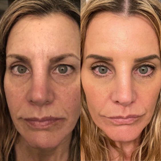 滚动 Pin 图图片 0