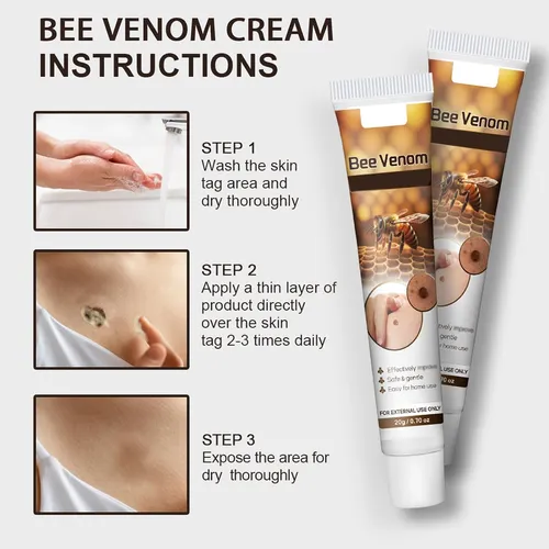 🔥Buy 1 Get 1 Free🔥Pain-free Bee Venom Wart and Tags Removoal Cream — Made for all skin types