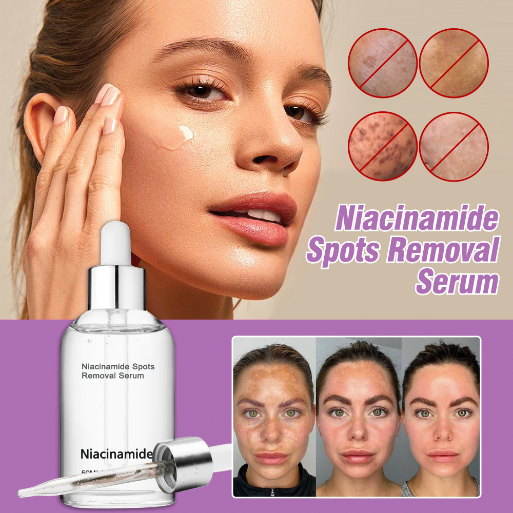 10% Niacinamide Spots Removal Serum