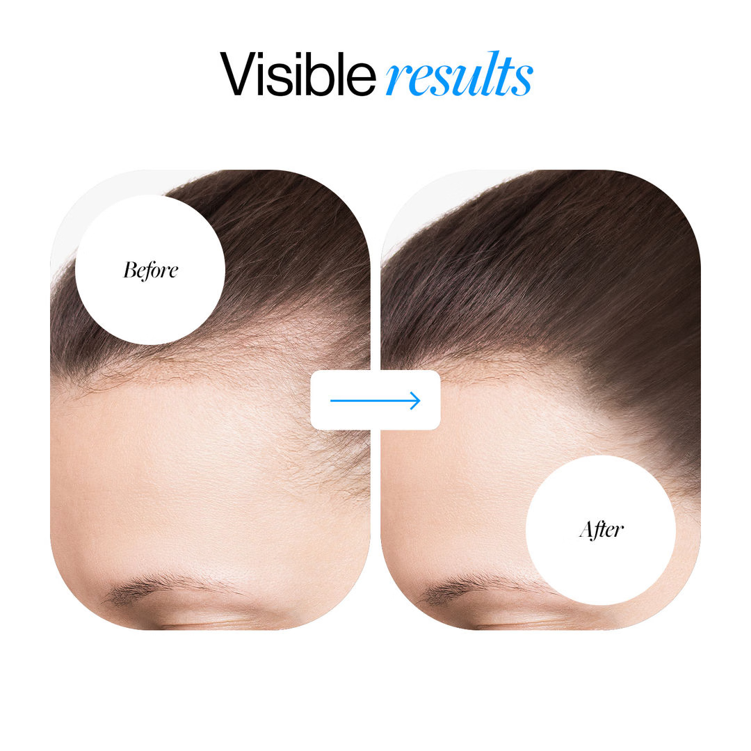 Bodywise™ Density Boost Roll-On Serum 5% Saw Palmetto DHT Balance Complex