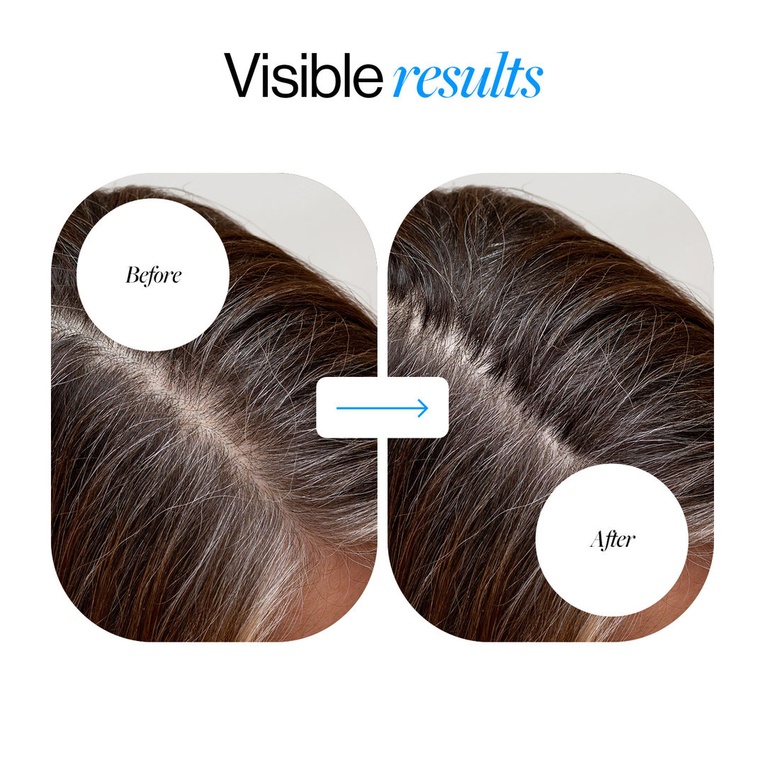 Bodywise™ Density Boost Roll-On Serum 5% Saw Palmetto DHT Balance Complex