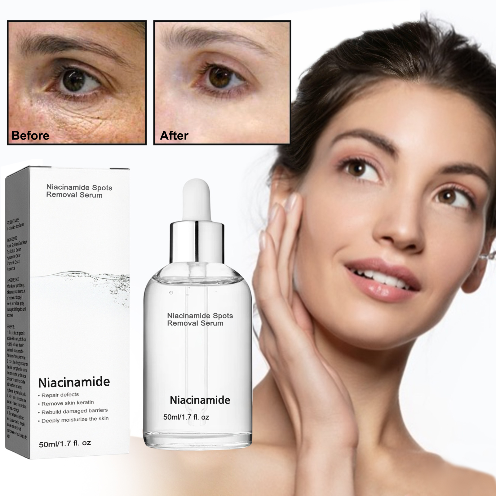 Niacinamide Spots Removal Serum💝Buy 2 Save $10💝