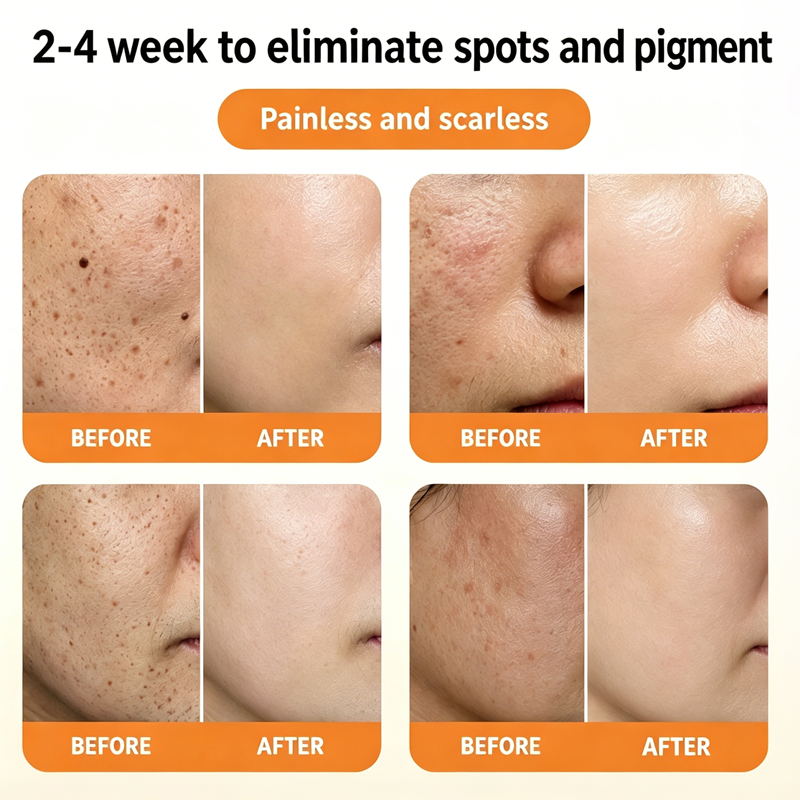 Herbal Spot Peel Off Mask