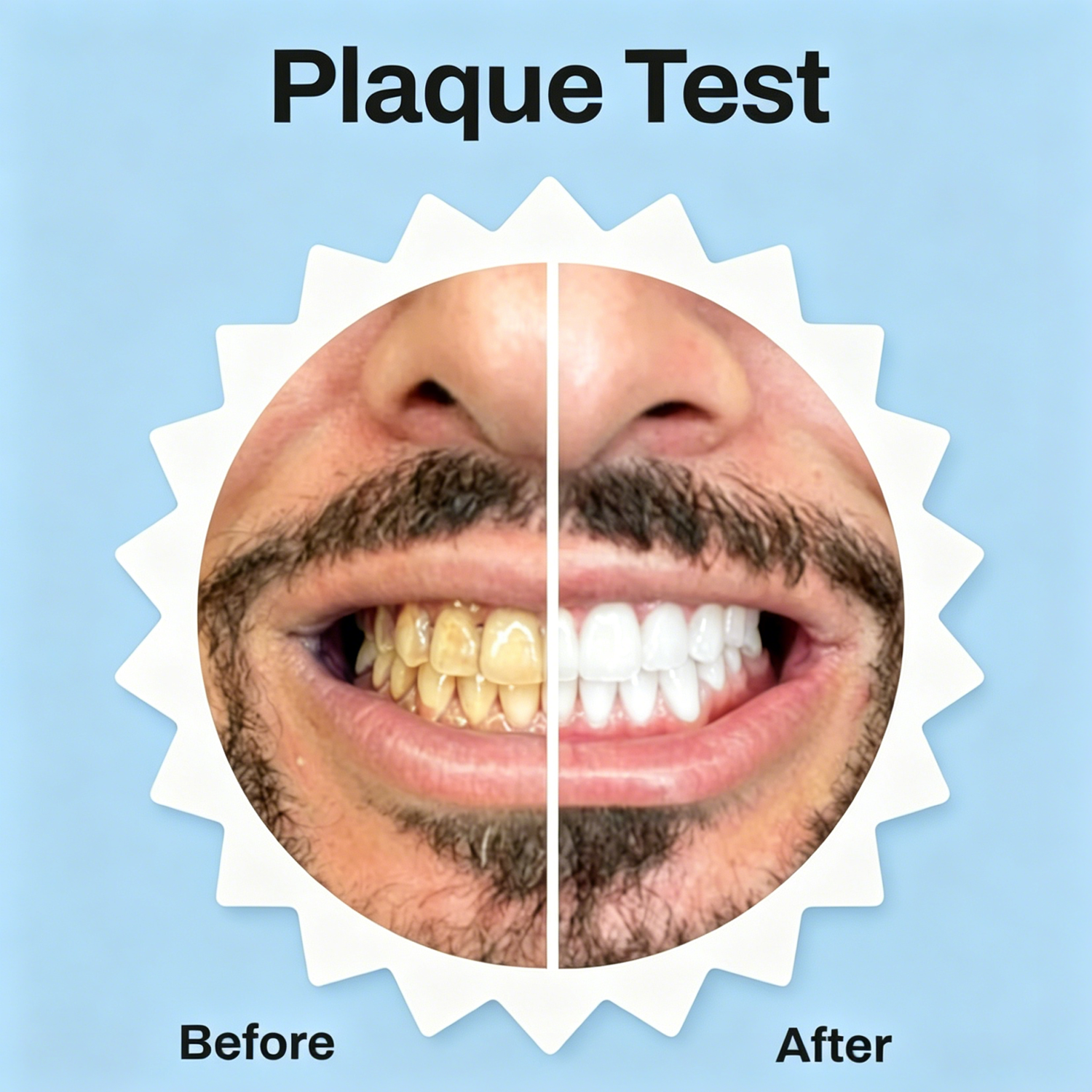 Hands-Free Ultrasonic Automatic Toothbrush