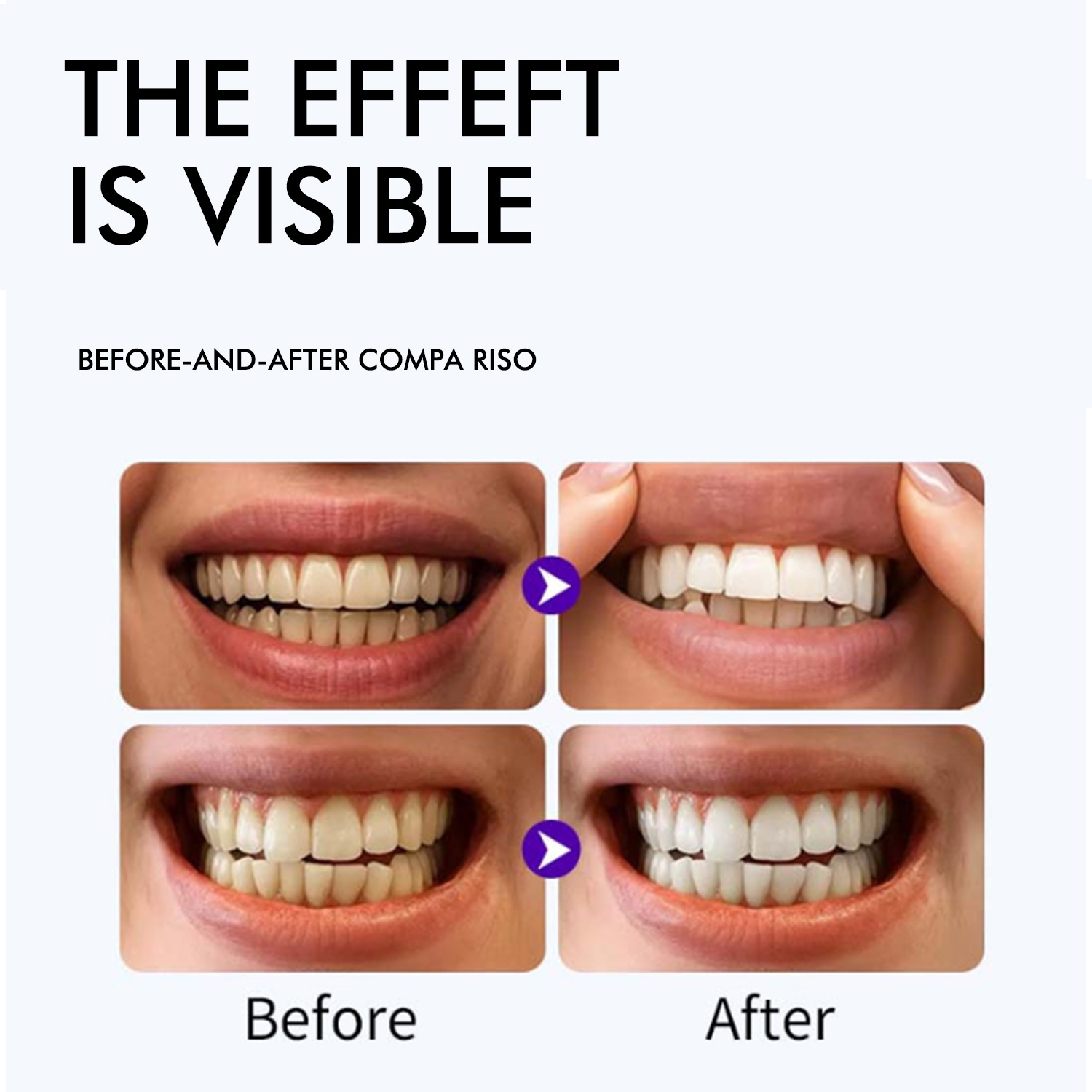Purple Teeth Whitening Strips