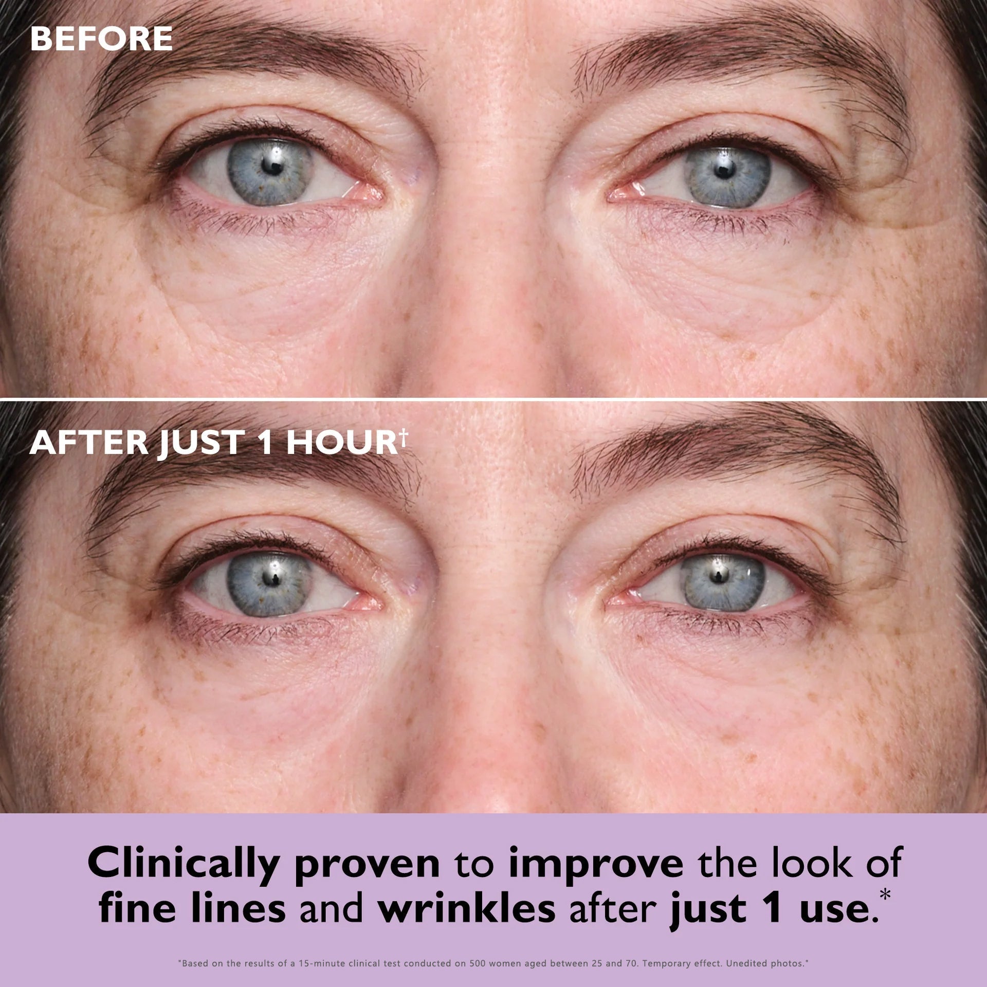 Instant Collagen Eye Patches – Bye Puffiness & Fine Lines
