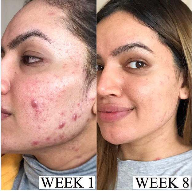 🔥Limited Time Offer🔥Collagen Overnight Wrapping Peel Off Facial Mask