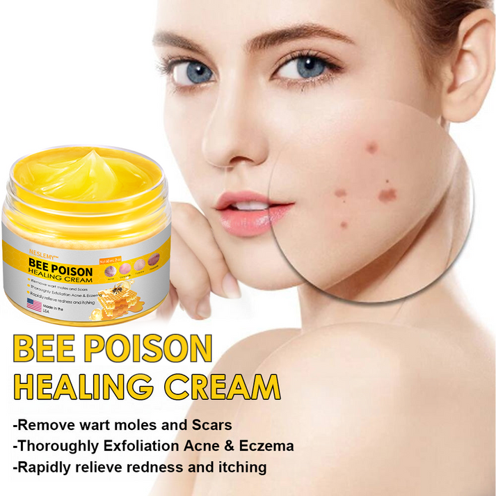 Bee Poison Skin Cream(👨‍⚕AAD Recommended),for Remove Warts, Acne and Scars