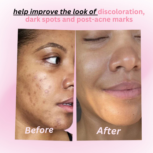 Turmeric Kojic Acid Cleansing Pads