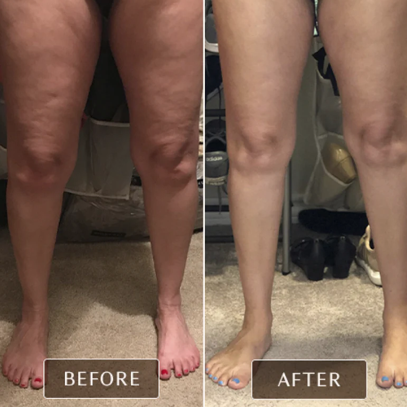 Cryo Thermo Firming Gold Gel