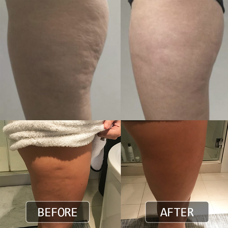 Cryo Thermo Firming Gold Gel