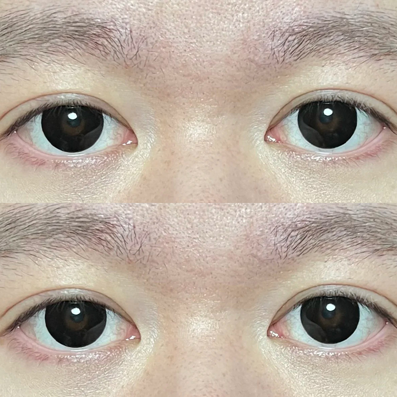 Block Black - 1 Year