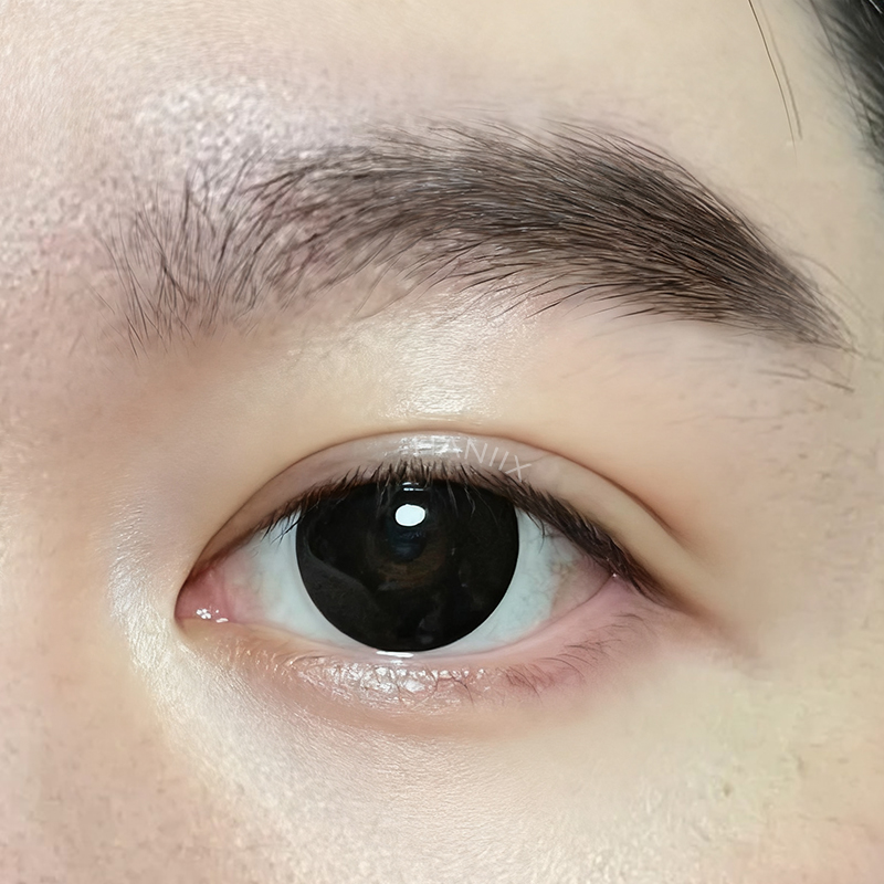 Block Black - 1 Year