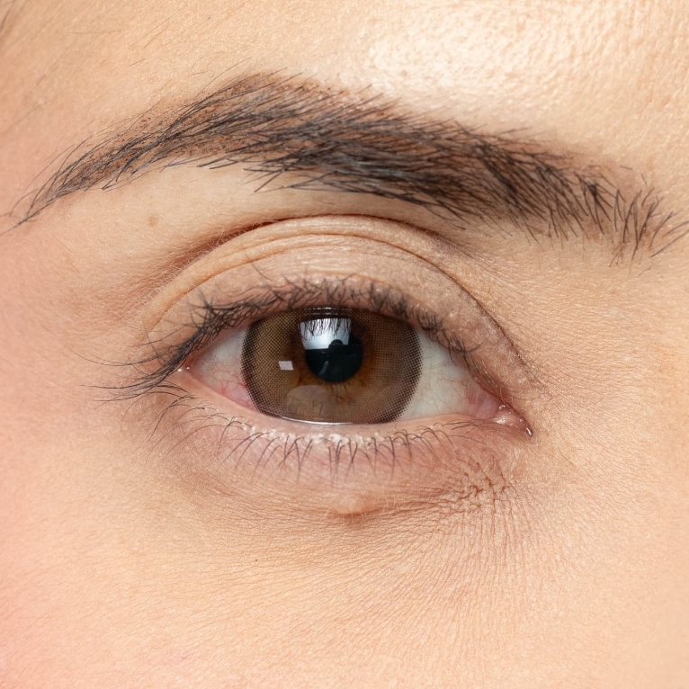 Fate Amber - 6 Months