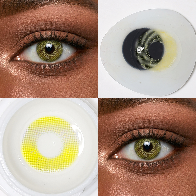 Nova Yellow - 1 Year