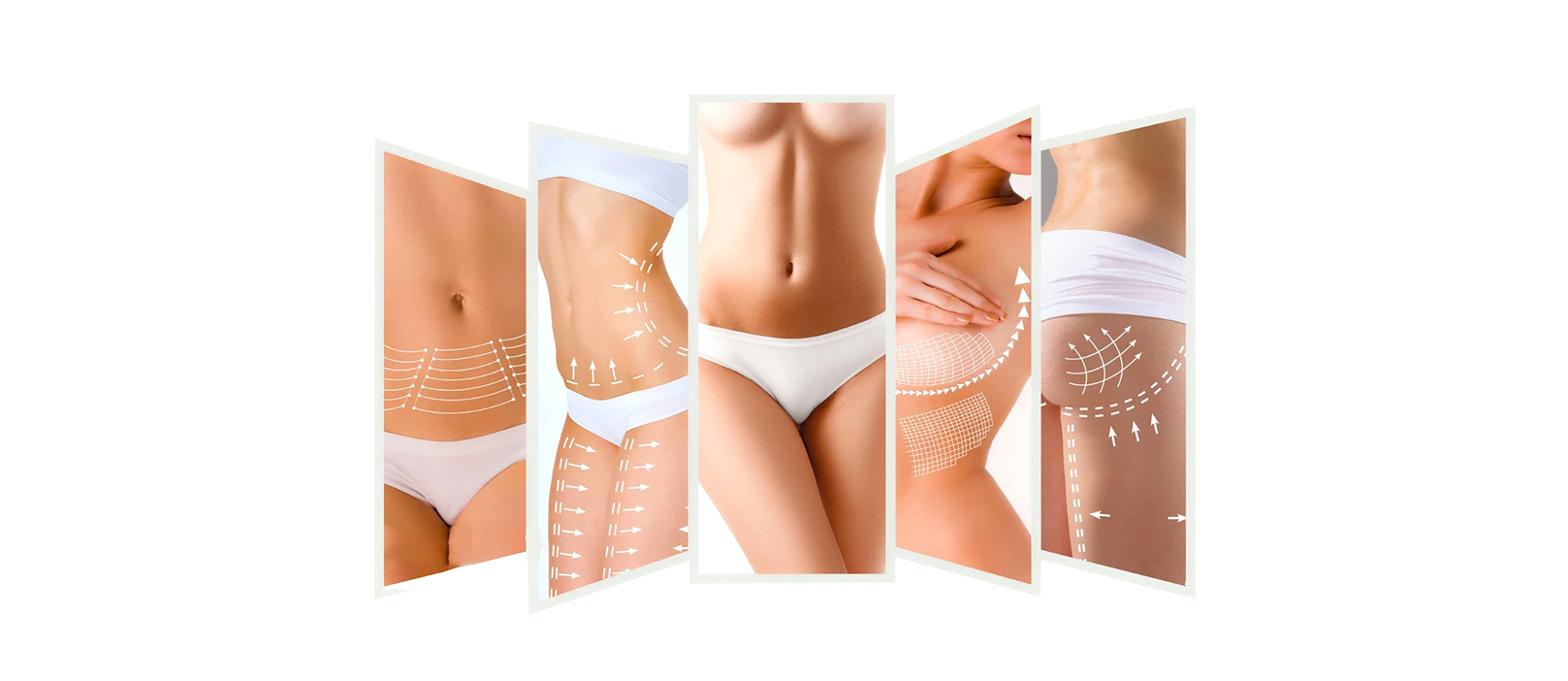 Say Goodbye to Stubborn Fat with Vacuum Cavitation System
