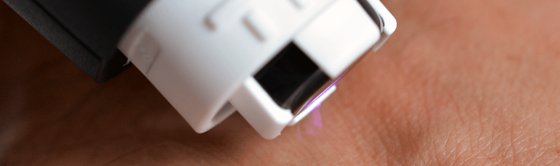 Advantages & Disadvantages of Plasma Cosmetic Treatments-GLM Beauty Spa Equipment Factory