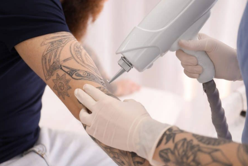 Laser tattoo removal: Minimize pain and discomfort-GLM Beauty Spa Equipment Factory