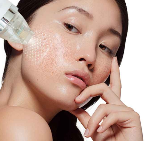Needle-free dot-matrix RF skin repair – GLM Beauty Spa Equipment Factory