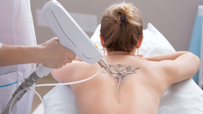The Ultimate Guide to Modern Tattoo Removal Machines-GLM Beauty Spa Equipment Factory