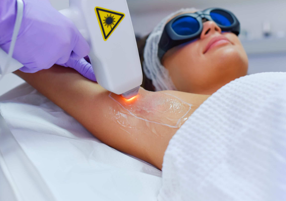 Does laser hair removal cause any pain or discomfort?-GLM Beauty Spa Equipment Factory