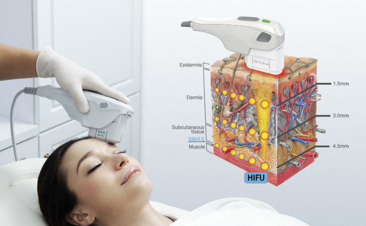 The Best Age for HIFU Skin Lift & Firm: A Comprehensive Guide-GLM Beauty Spa Equipment Factory