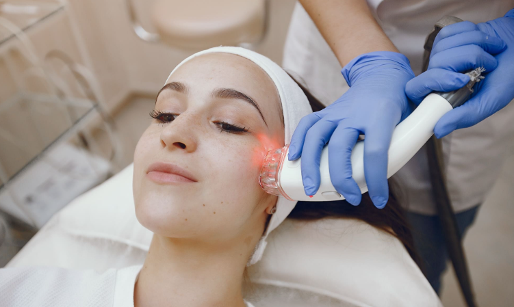 Treating Freckles: The Power of Lentigo Laser Therapy-GLM Beauty Spa Equipment Factory