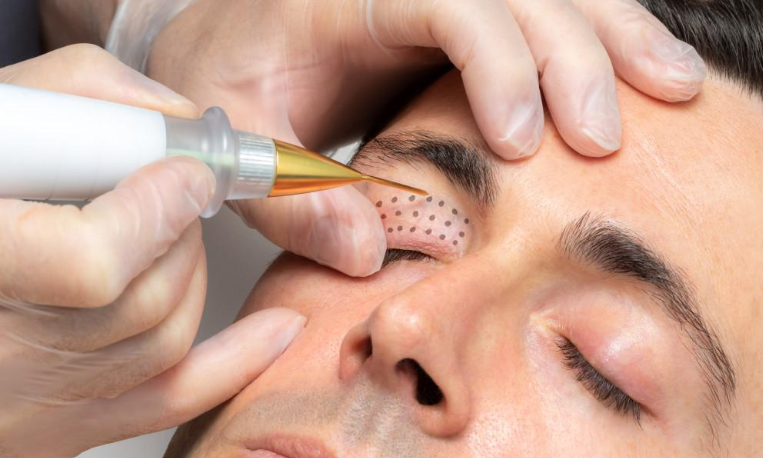 Is Plasma Beauty Device Worth the Investment?-GLM Beauty Spa Equipment Factory