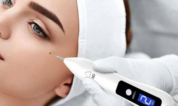 Plasma Pen Mole Removal: A Safe and Effective Method-GLM Beauty Spa Equipment Factory