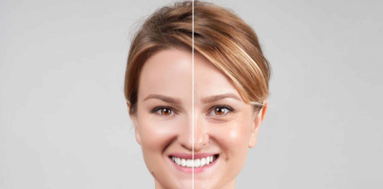 The effect of HIFU on firming the skin-GLM Beauty Spa Equipment Factory