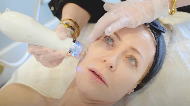 What are the benefits and risks of frequent microneedling sessions?-GLM Beauty Spa Equipment Factory