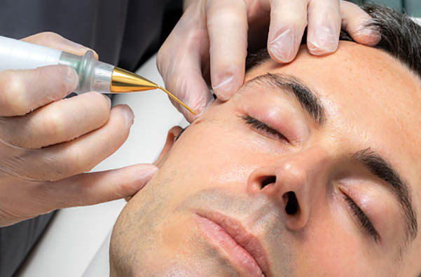 What are plasma pen fibroblasts-GLM Beauty Spa Equipment Factory