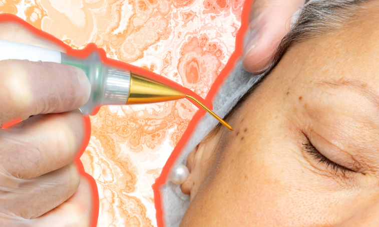 What are the benefits of using a plasma beauty device for facial spots?-GLM Beauty Spa Equipment Factory