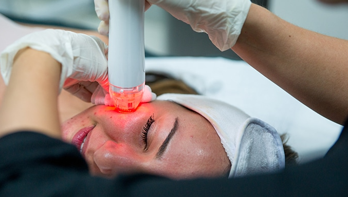Microcrystalline peels versus microneedle therapy: Which treatment is better-GLM Beauty Spa Equipment Factory