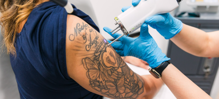 How to choose a laser tattoo removal machine in China?-GLM Beauty Spa Equipment Factory