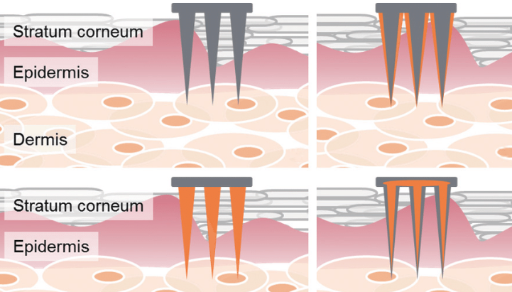 Can I apply makeup after microneedle treatment?-GLM Beauty Spa Equipment Factory