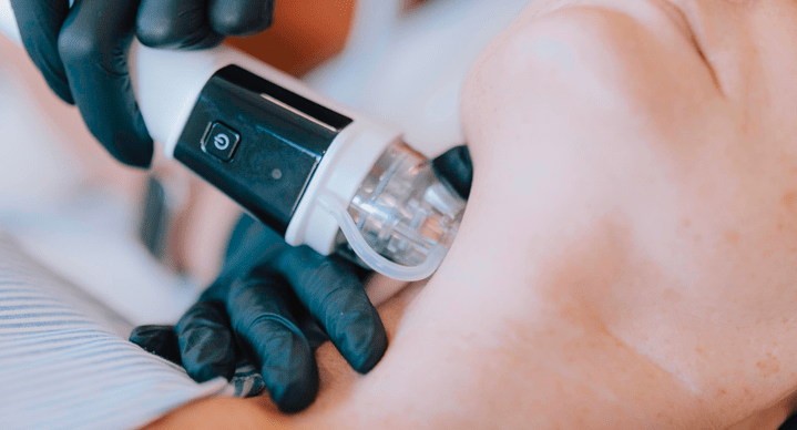 Beauty shaping therapy and microneedle therapy-GLM Beauty Spa Equipment Factory