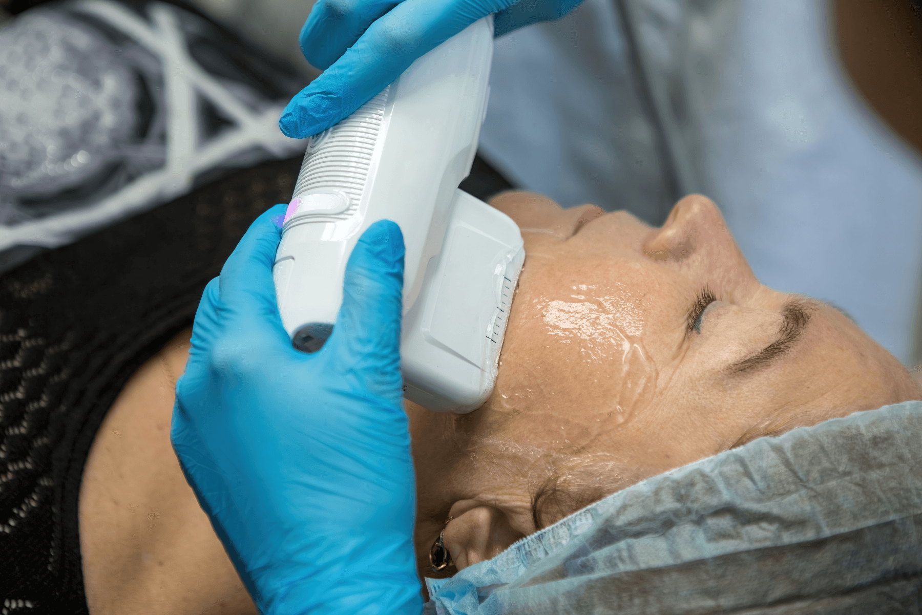 Face Lift in Gurgaon, India | Face Lifting Treatment in Gurgaon #1