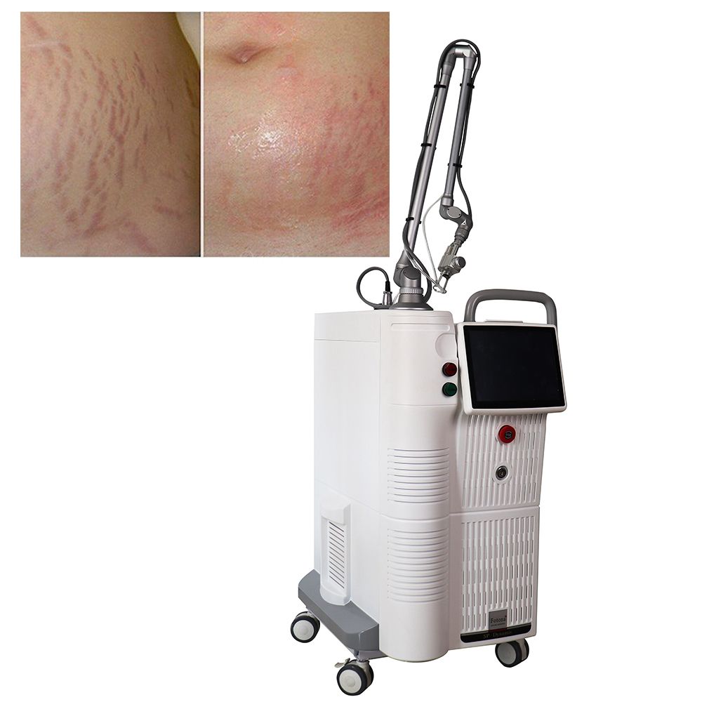Omanli CO2 Fractional Laser Machine Vaginal Tightening Freckles Stretch ...