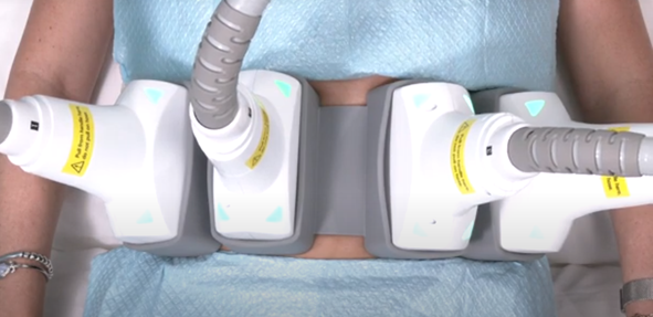 LASER BODY SCULPTING | AnewSkin Aesthetic Clinic and Medical Spa