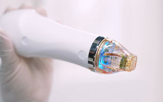 RF Microneedling | MoleSpot Clinic - Advanced Skin Rejuvenation