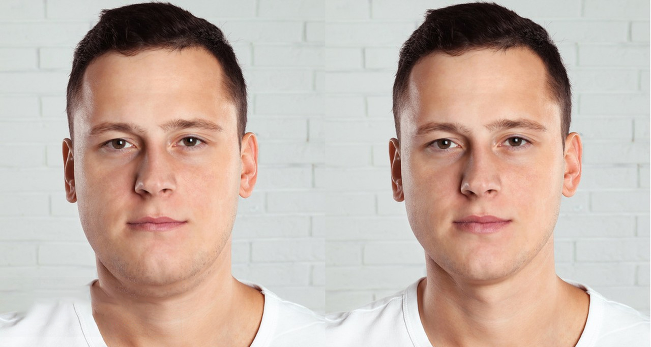 Preventing and Addressing Potential Causes of Double Chin