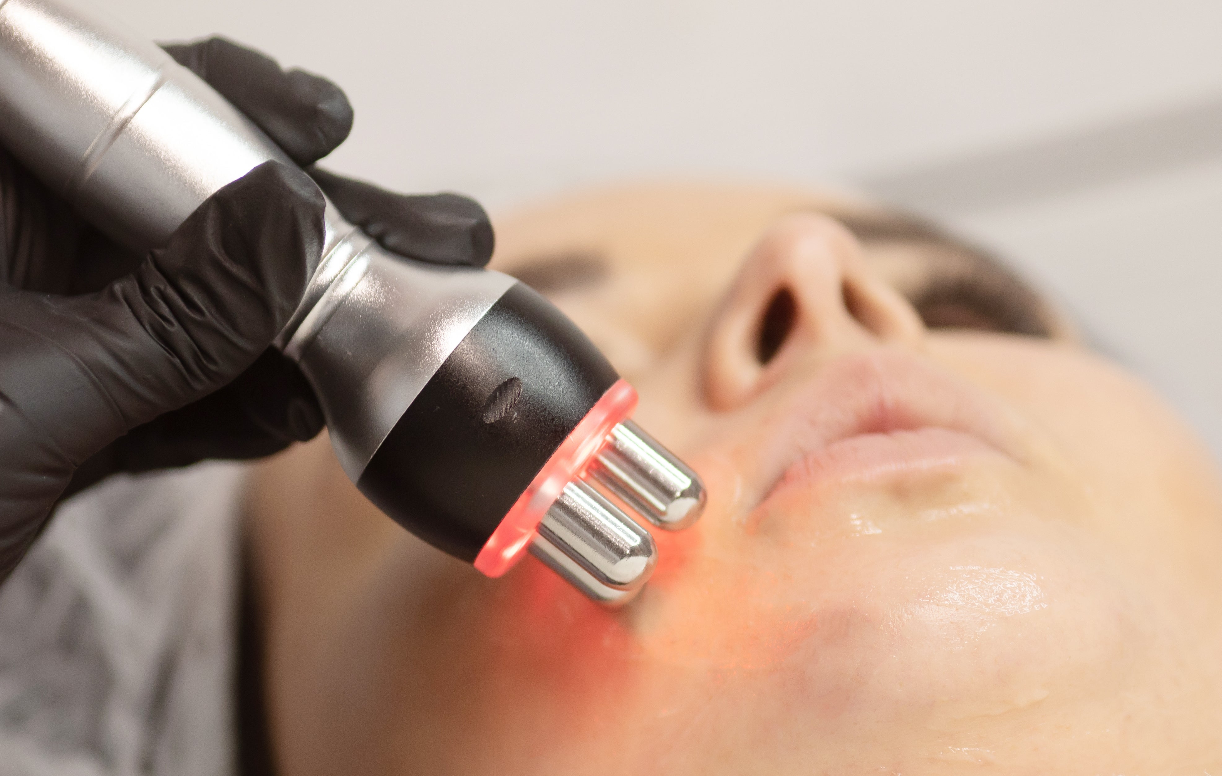 Radio Frequency Facial