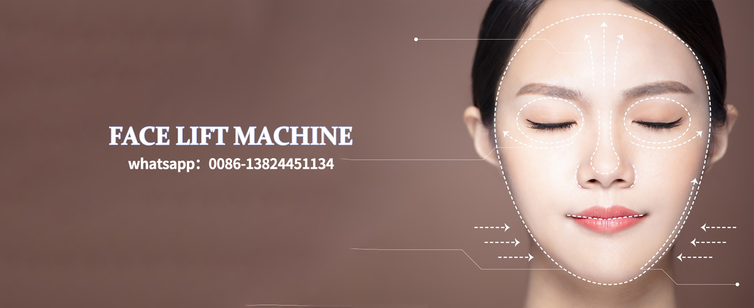 What are some noticeable changes that can be seen in a person's appearance after a face lift?