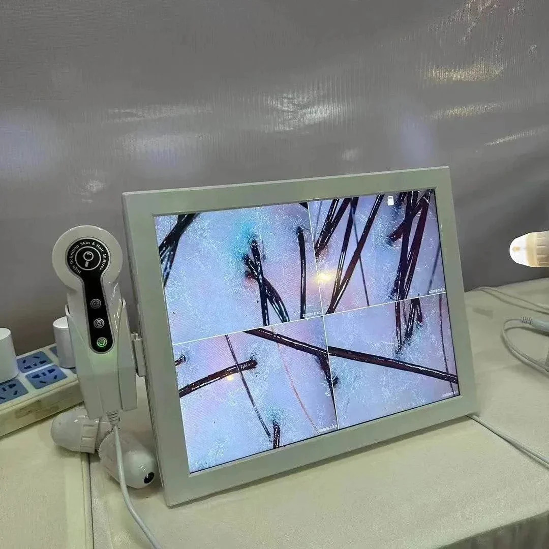 Professional digital scalp analyzer